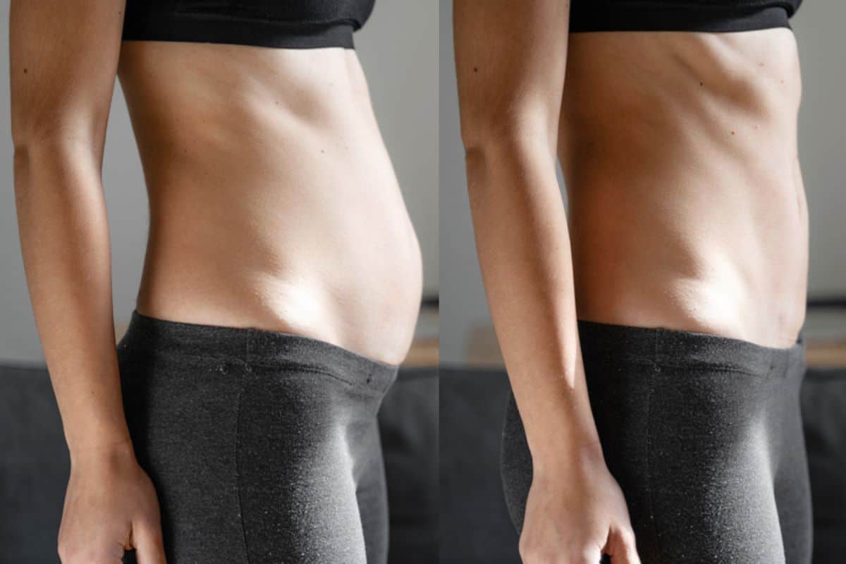 Post-Pregnancy: What Happens to Your Abdominal Muscles After Birth Greater London (Barnet)