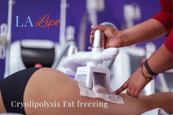 women getting fat freezing Greater London (Barnet)