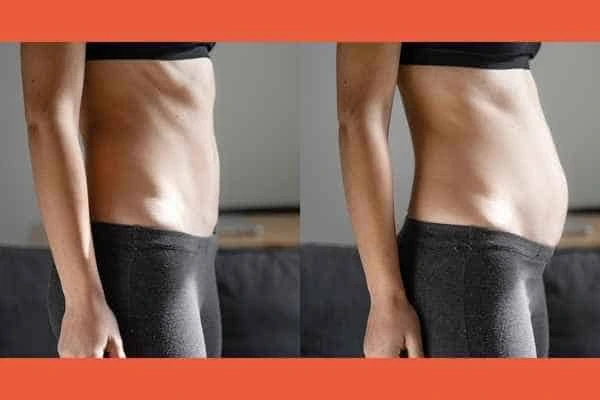 LA-EMS Body Sculpting results Greater London (Barnet)