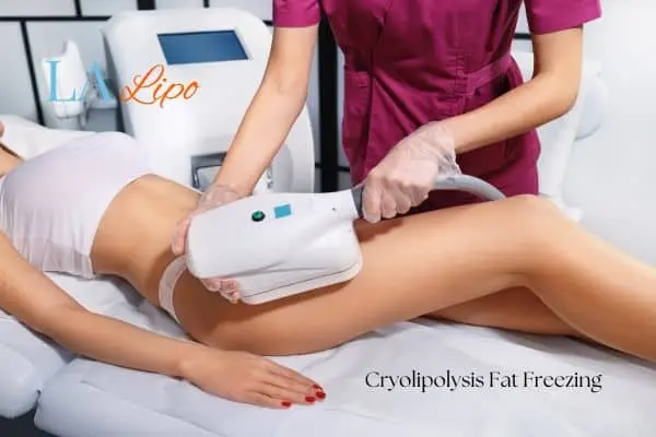 Woman receiving coolsculpting Greater London (Barnet) treatment on her thighs