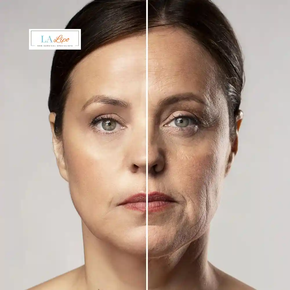 How Can You Tell If Non-Surgical Skin Tightening Is Right for You Greater London (Barnet)?
