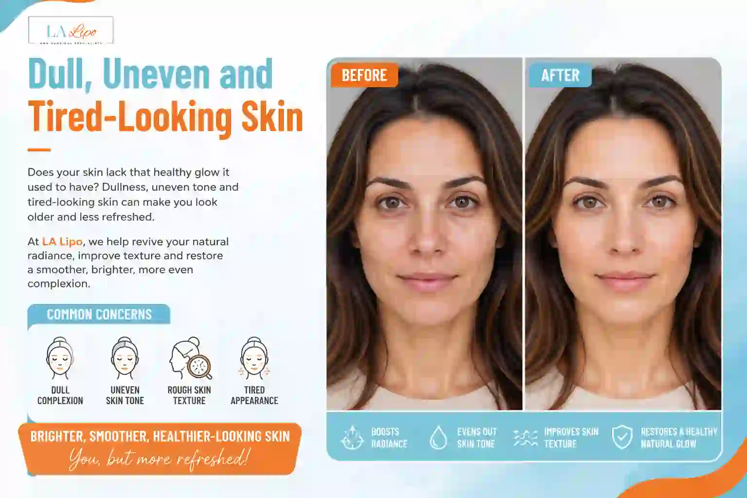 Sign #5: Dull, Uneven and Tired-Looking Skin Greater London (Barnet)