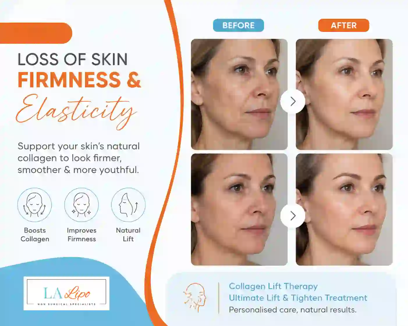 Sign #7: Loss of Skin Firmness and Elasticity Greater London (Barnet)