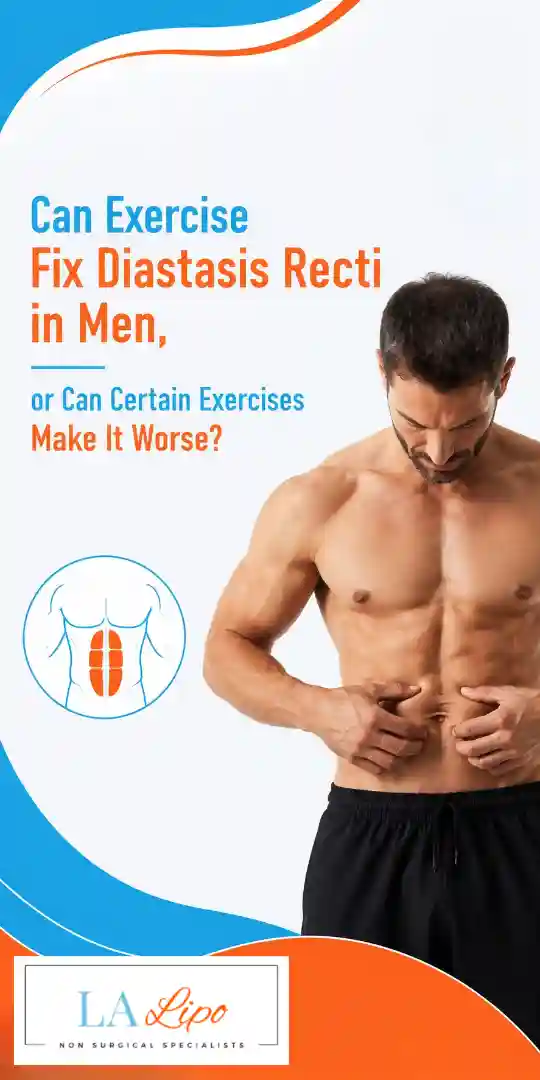 Can Exercise Fix Diastasis Recti in Men, or Can Certain Exercises Make It Worse Greater London (Barnet)?